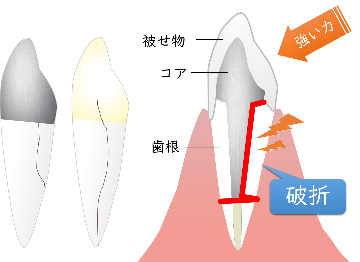 柏市(逆井)の歯医者、伊藤歯科クリニックの歯科用CT